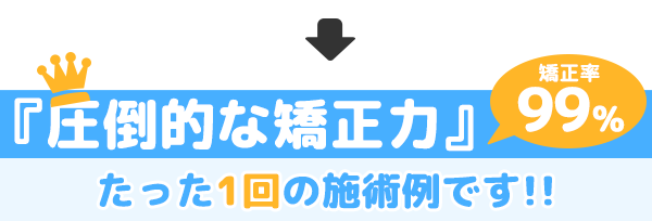 巻き爪あきらめてませんか?簡単に改善できます。施術も痛くない